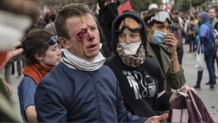 Dezenas de feridos pela repressão brutal em Paris, um manifestante perdeu o olho